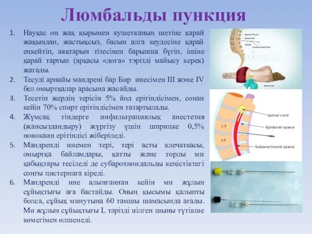 Люмбальды пункция Науқас оң жақ қырымен кушетканың шетіне қарай жақындап, жастықсыз, басын алга