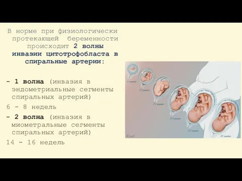 В норме при физиологически протекающей беременности происходит 2 волны инвазии цитотрофобласта в спиральные