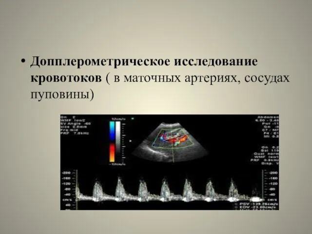 Допплерометрическое исследование кровотоков ( в маточных артериях, сосудах пуповины)