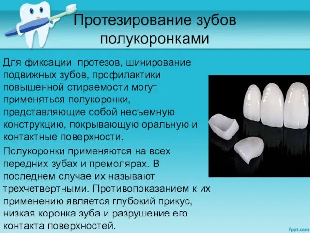 Протезирование зубов полукоронками Для фиксации протезов, шинирование подвижных зубов, профилактики