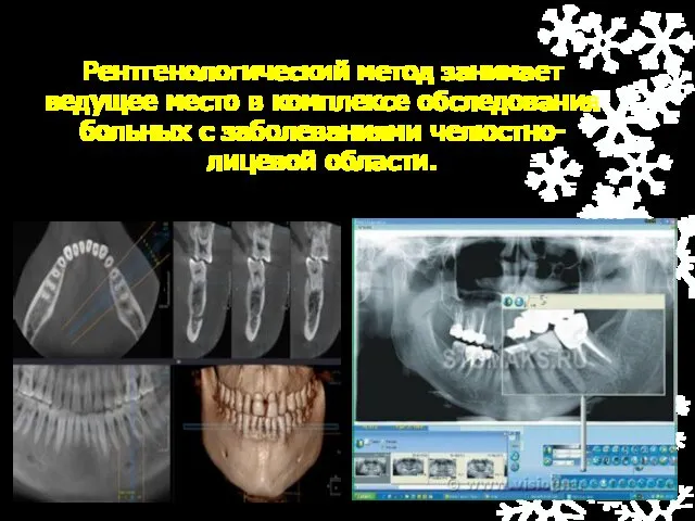 Рентгенологический метод занимает ведущее место в комплексе обследования больных с заболеваниями челюстно-лицевой области.