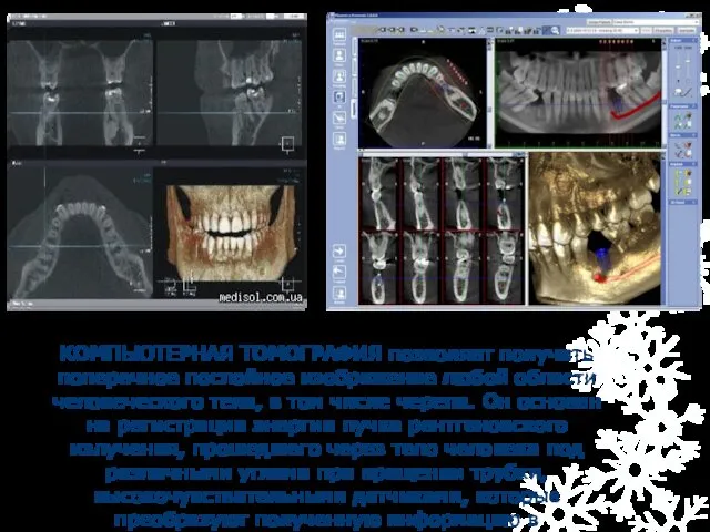 КОМПЬЮТЕРНАЯ ТОМОГРАФИЯ позволяет получить поперечное послойное изображение любой области человеческого