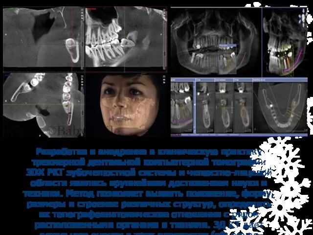 Разработка и внедрение в клиническую практику трехмерной дентальной компьютерной томографии