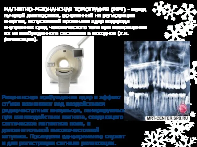 МАГНИТНО-РЕЗОНАНСНАЯ ТОМОГРАФИЯ (МРТ) - метод лучевой диагностики, основанный на регистрации