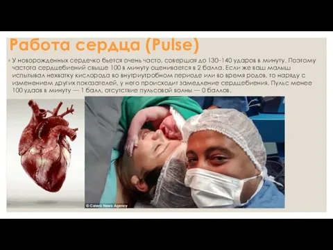 Работа сердца (Pulse) У новорожденных сердечко бьется очень часто, совершая