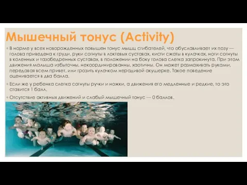 Мышечный тонус (Activity) В норме у всех новорожденных повышен тонус