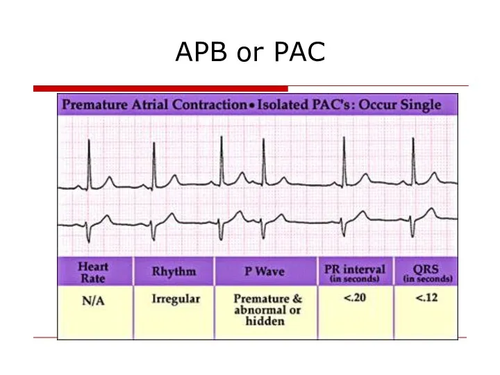 APB or PAC