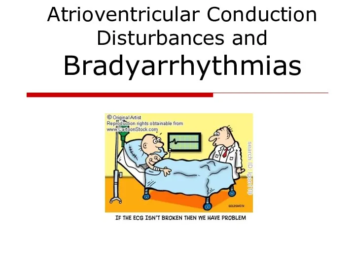 Atrioventricular Conduction Disturbances and Bradyarrhythmias