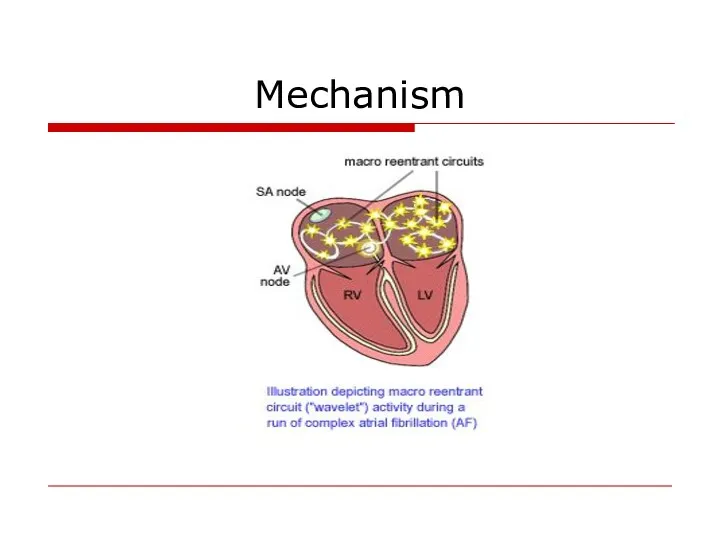 Mechanism