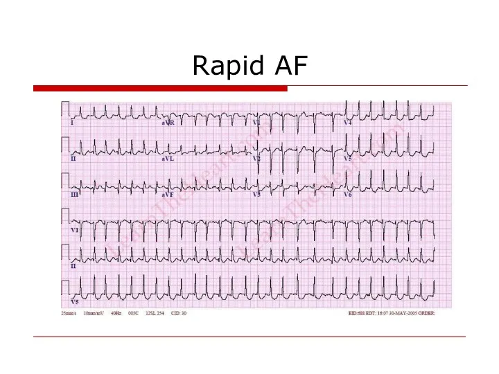 Rapid AF