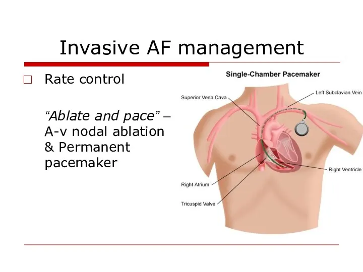 Invasive AF management Rate control “Ablate and pace” – A-v nodal ablation & Permanent pacemaker