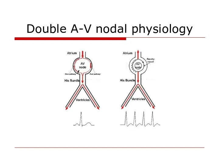 Double A-V nodal physiology