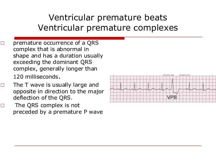 Ventricular premature beats Ventricular premature complexes premature occurrence of a