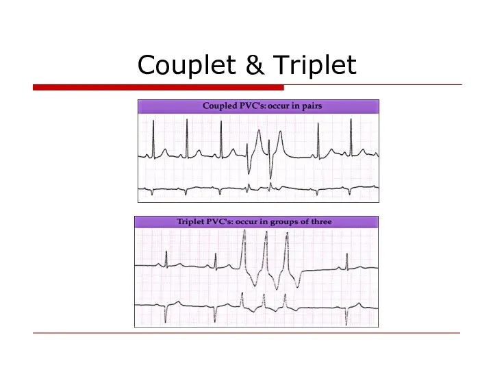 Couplet & Triplet