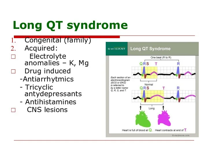 Long QT syndrome Congenital (family) Acquired: Electrolyte anomalies – K,