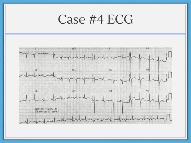Case #4 ECG