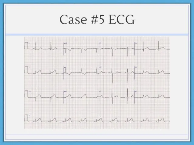 Case #5 ECG