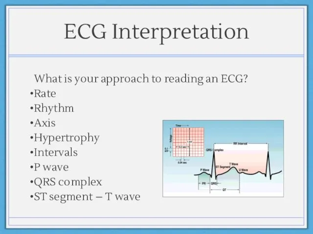 ECG Interpretation What is your approach to reading an ECG?