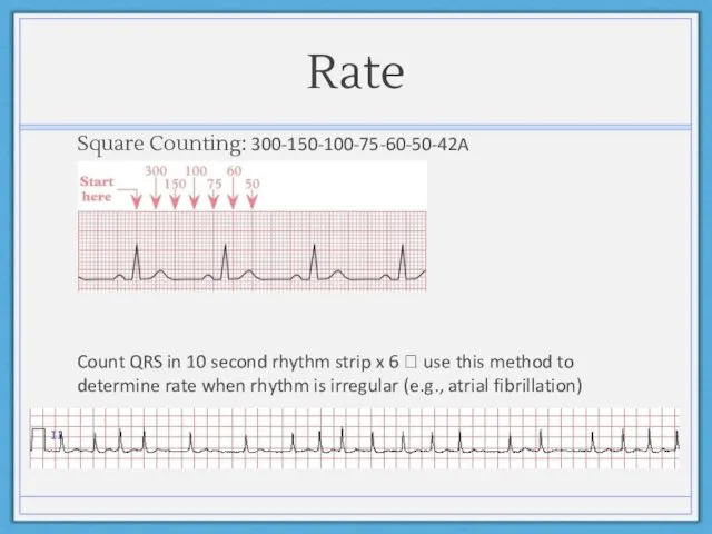 Rate Square Counting: 300-150-100-75-60-50-42A Count QRS in 10 second rhythm