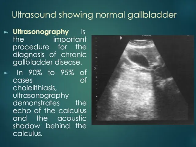 Ultrasound showing normal gallbladder Ultrasonography is the important procedure for