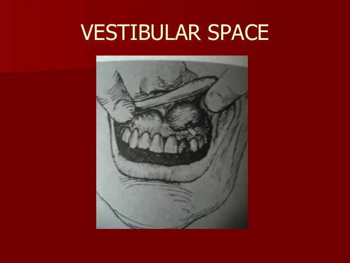 VESTIBULAR SPACE