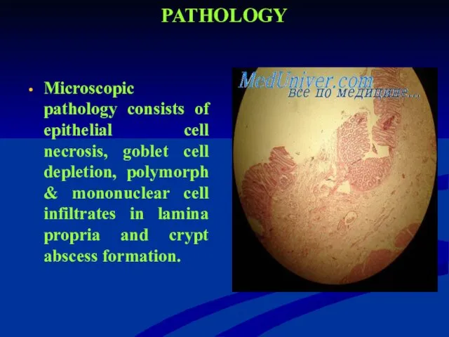 PATHOLOGY Microscopic pathology consists of epithelial cell necrosis, goblet cell