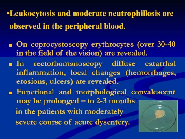 Leukocytosis and moderate neutrophillosis are observed in the peripheral blood.