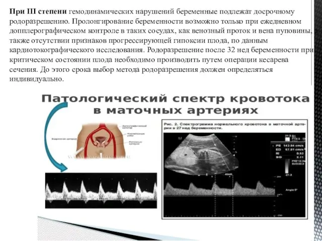 При III степени гемодинамических нарушений беременные подлежат досрочному родоразрешению. Пролонгирование