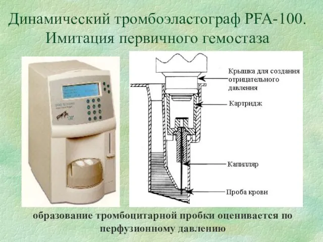 Динамический тромбоэластограф PFA-100. Имитация первичного гемостаза образование тромбоцитарной пробки оценивается по перфузионному давлению