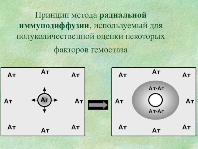 Принцип метода радиальной иммунодиффузии, используемый для полуколичественной оценки некоторых факторов гемостаза