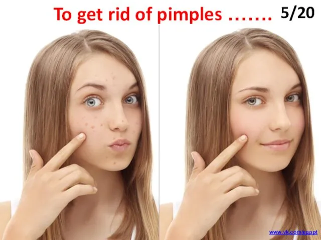 To get rid of pimples ……. 5/20 www.vk.com/egppt