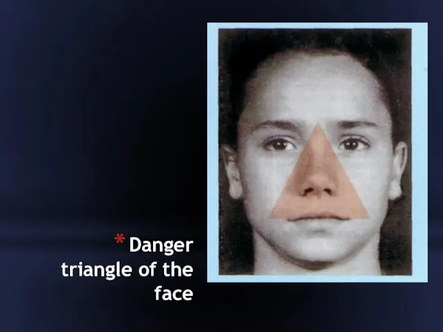 Danger triangle of the face