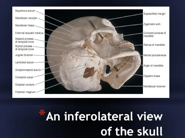 An inferolateral view of the skull
