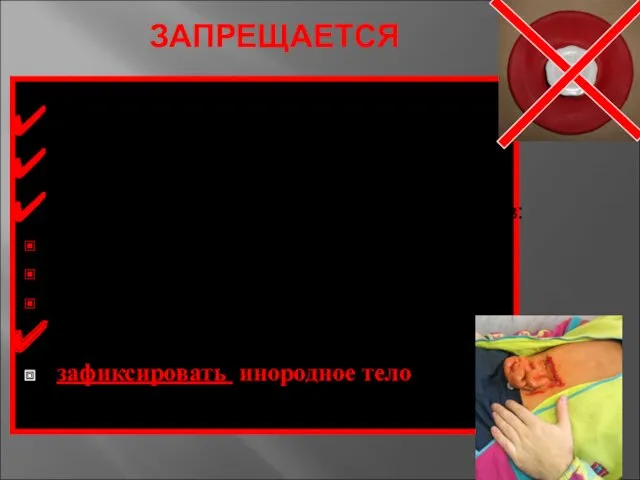 ЗАПРЕЩАЕТСЯ Поить, даже при сильной жажде Обезболивать таблетками, алкоголем При