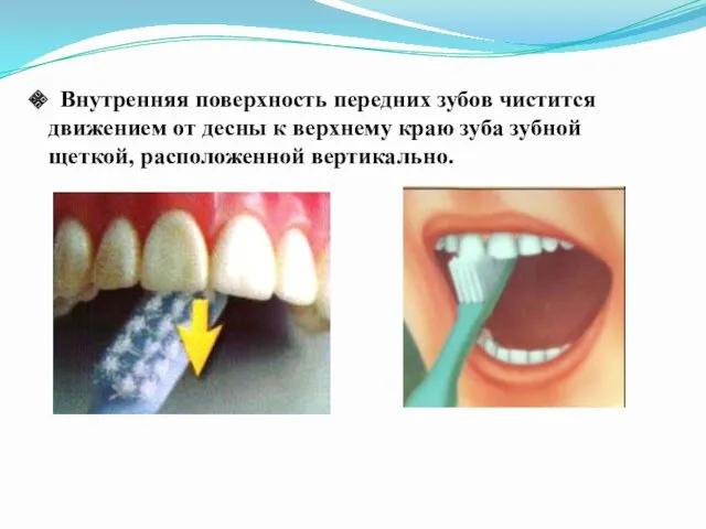 Внутренняя поверхность передних зубов чистится движением от десны к верхнему краю зуба зубной щеткой, расположенной вертикально.