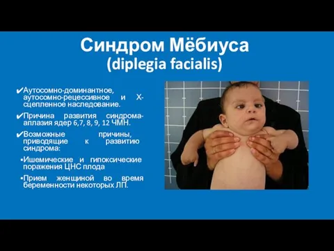 Синдром Мёбиуса (diplegia facialis) Аутосомно-доминантное, аутосомно-рецессивное и Х-сцепленное наследование. Причина