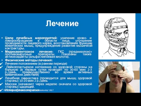 Лечение Цели лечебных мероприятий: усиление крово- и лимфообращения в области