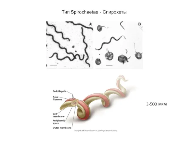 Тип Spirochaetae - Спирохеты 3-500 мкм