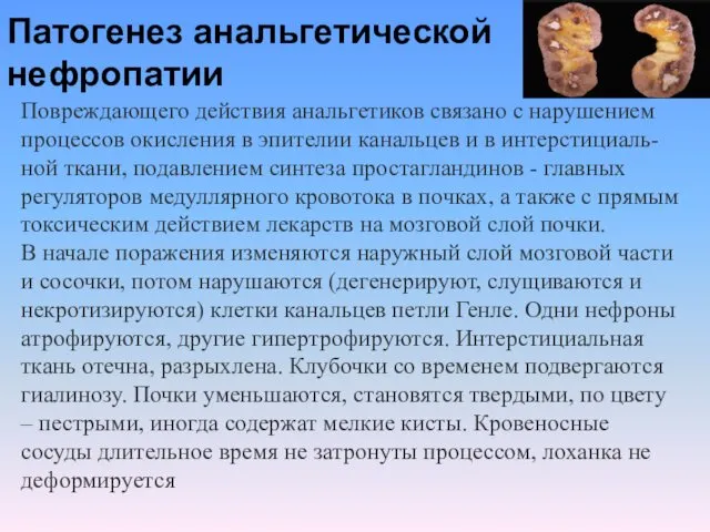 Патогенез анальгетической нефропатии Повреждающего действия анальгетиков связано с нарушением процессов