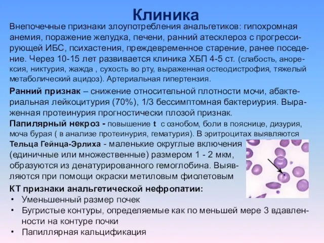 Клиника Внепочечные признаки злоупотребления анальгетиков: гипохромная анемия, поражение желудка, печени,