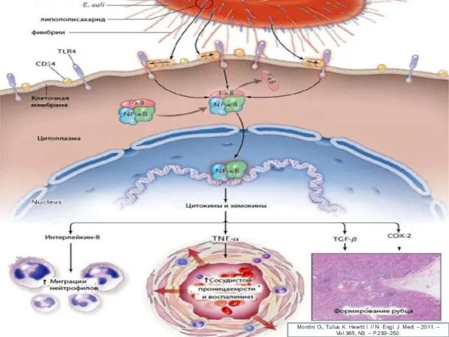 Montini G., Tullus K. Hewitt I. // N. Engl. J.