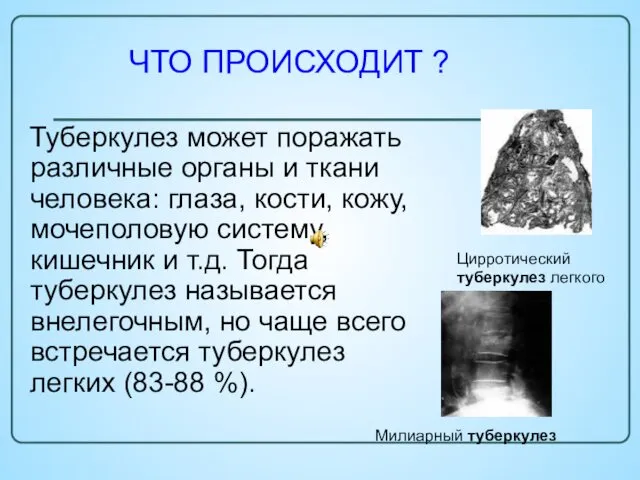 Туберкулез может поражать различные органы и ткани человека: глаза, кости, кожу, мочеполовую систему,