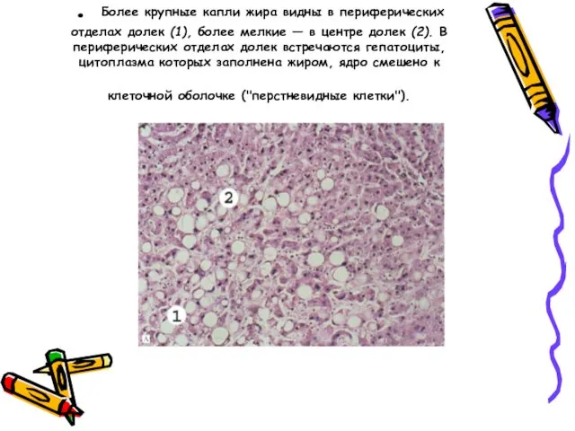 . Более крупные капли жира видны в периферических отделах долек