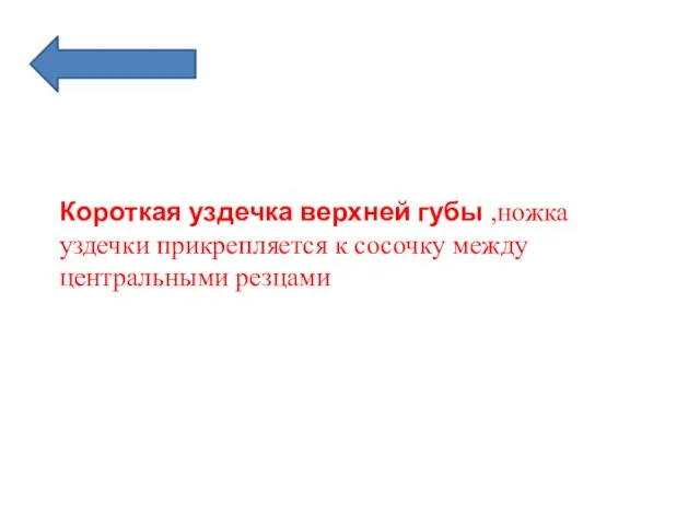 Короткая уздечка верхней губы ,ножка уздечки прикрепляется к сосочку между центральными резцами