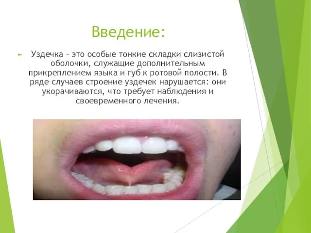 Введение: Уздечка – это особые тонкие складки слизистой оболочки, служащие