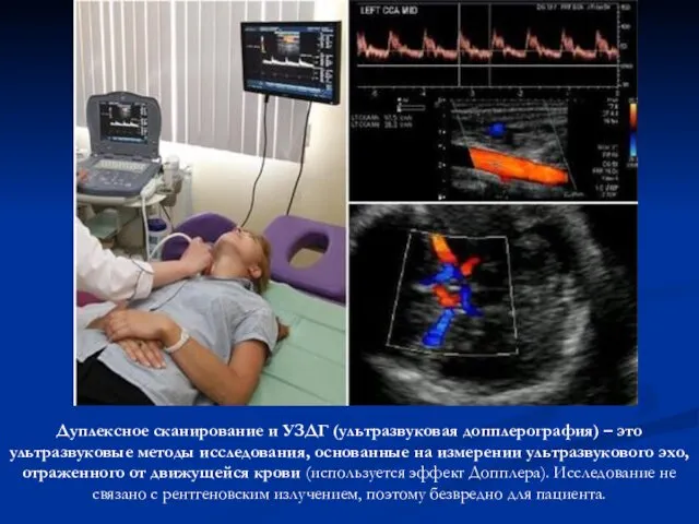 Дуплексное сканирование и УЗДГ (ультразвуковая допплерография) – это ультразвуковые методы