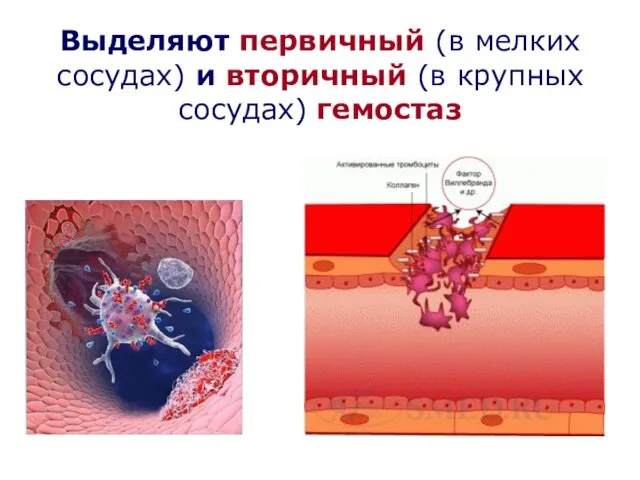 Выделяют первичный (в мелких сосудах) и вторичный (в крупных сосудах) гемостаз