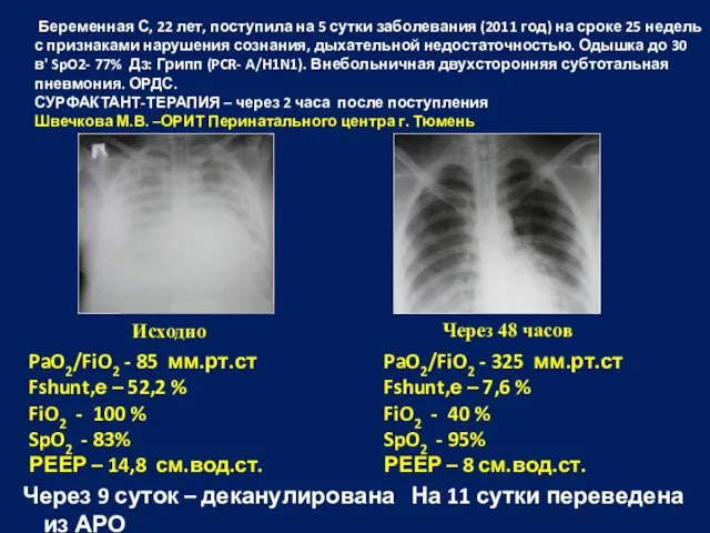 Исходно Через 48 часов Через 9 суток – деканулирована На 11 сутки переведена