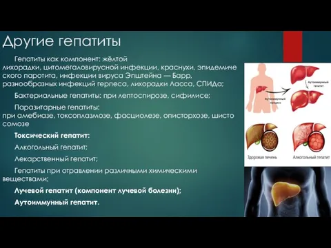 Другие гепатиты Гепатиты как компонент: жёлтой лихорадки, цитомегаловирусной инфекции, краснухи,