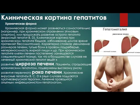 Клиническая картина гепатитов Хроническая форма Хроническая форма может развиваться самостоятельно